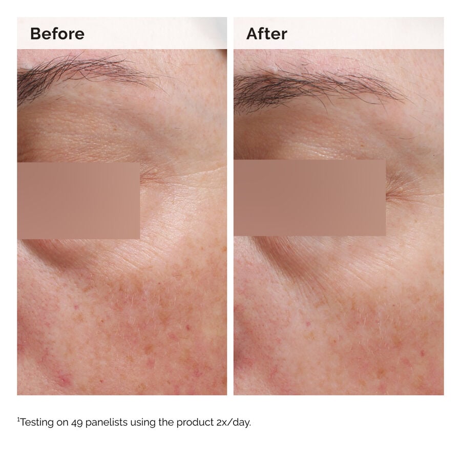 niacinamide-5-face-and-body-emulsion-e0 2024-08-23-ORD-Nia-5pct-Face-Body-B-A-Elasticity-Global-02-1x1.jpg