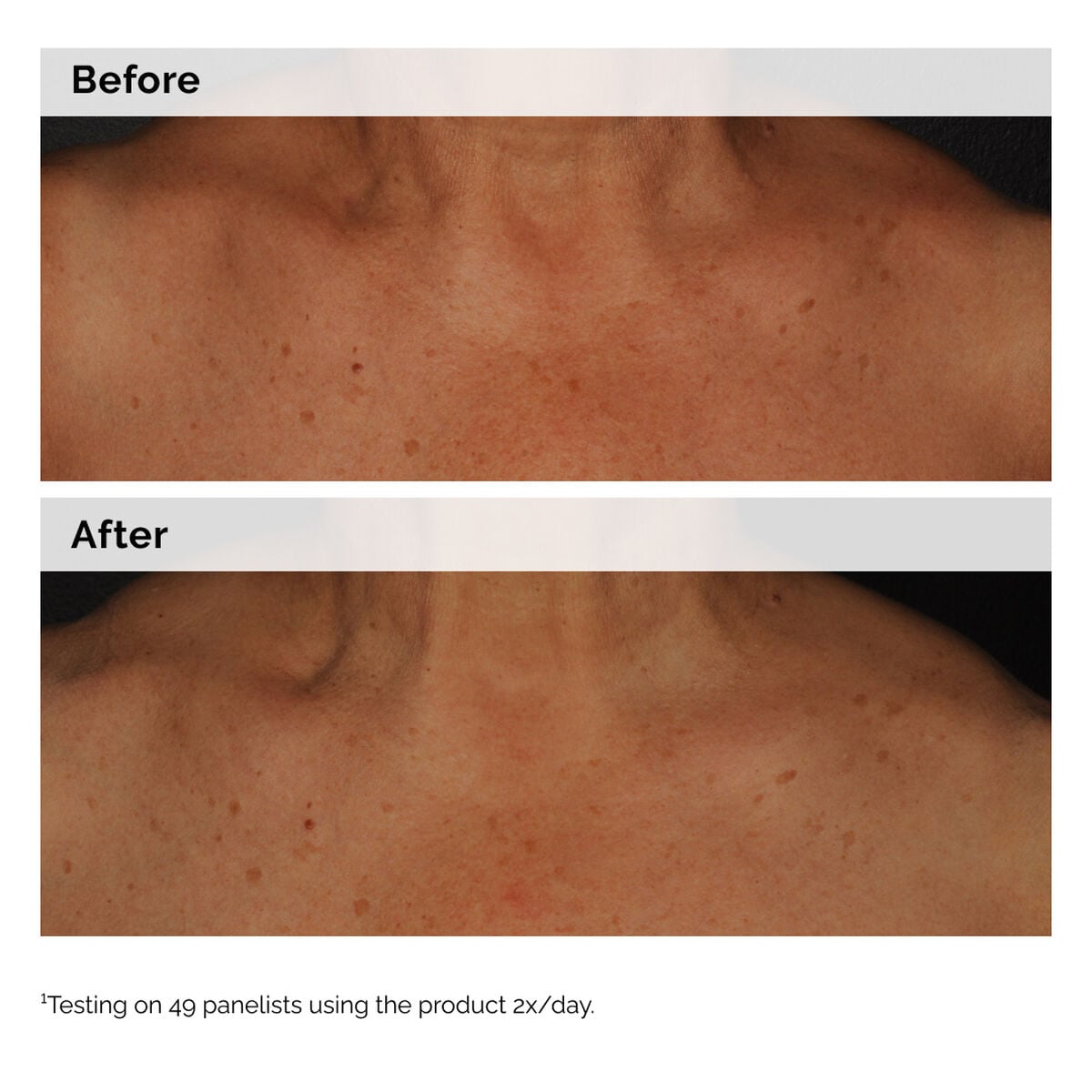 niacinamide-5-face-and-body-emulsion-e0 2024-08-23-ORD-Nia-5pct-Face-Body-B-A-Global-02-1x1.jpg
