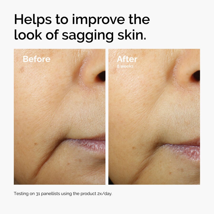 caffeine-3-escin-1-face-serum-p2 ord-caffeine-3pct-escin-1pct-face-serum-before-after-sagging.jpg
