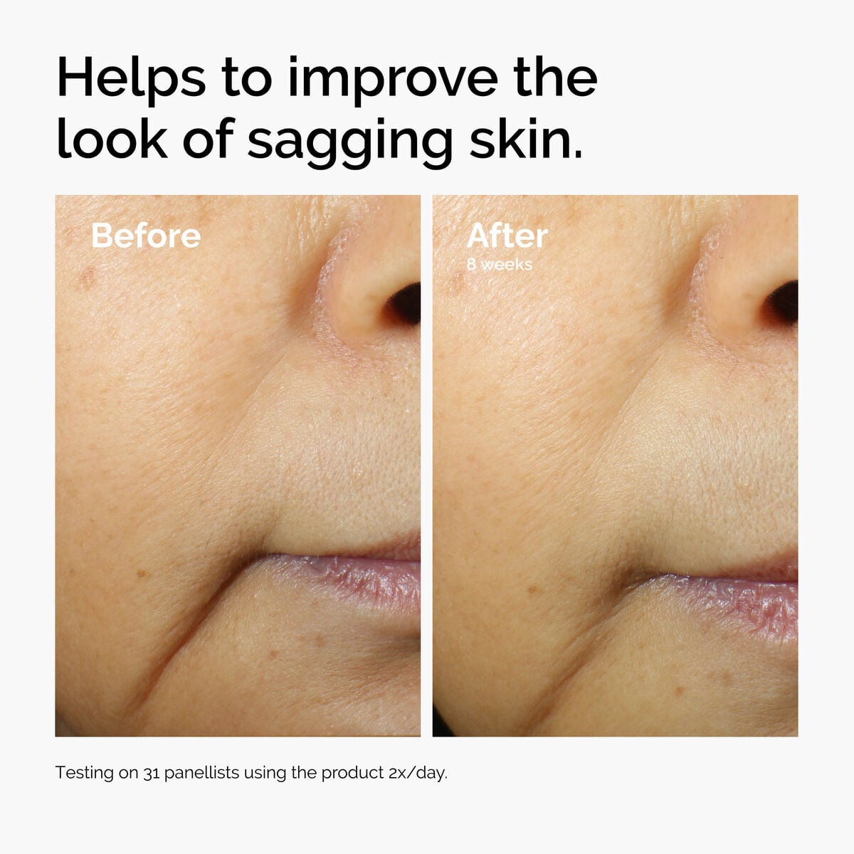 caffeine-3-escin-1-face-serum-p2 ord-caffeine-3pct-escin-1pct-face-serum-before-after-sagging.jpg