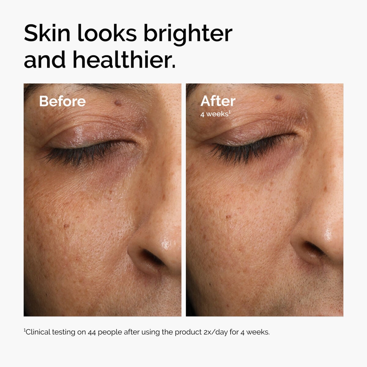 multi-antioxidant-radiance-serum-d2 ord-mars-before-after-healthy.jpg