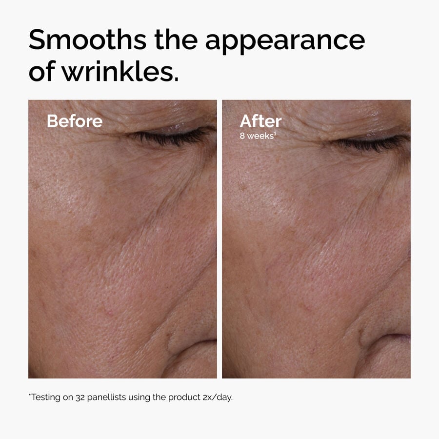 multi-peptide-ha-serum-c0 ord-multi-peptide-ha-serum-wrinkles-before-after.jpg