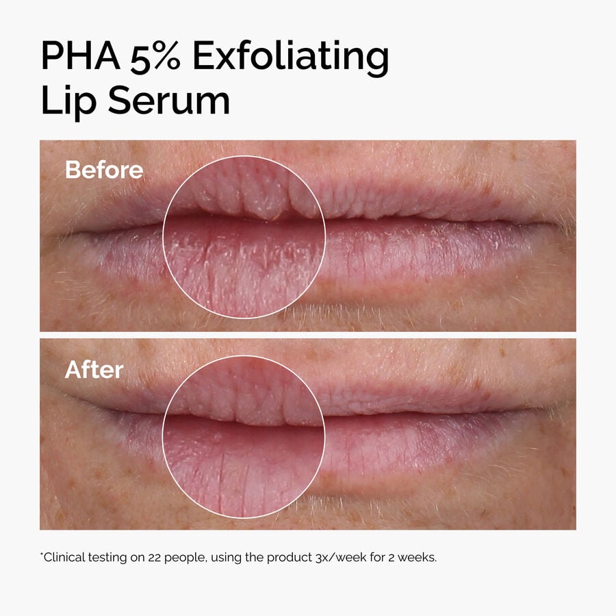 pha-5-exfoliating-lip-serum-t8 ord-pha-5pct-lip-exfoliating-serum-before-after.jpg