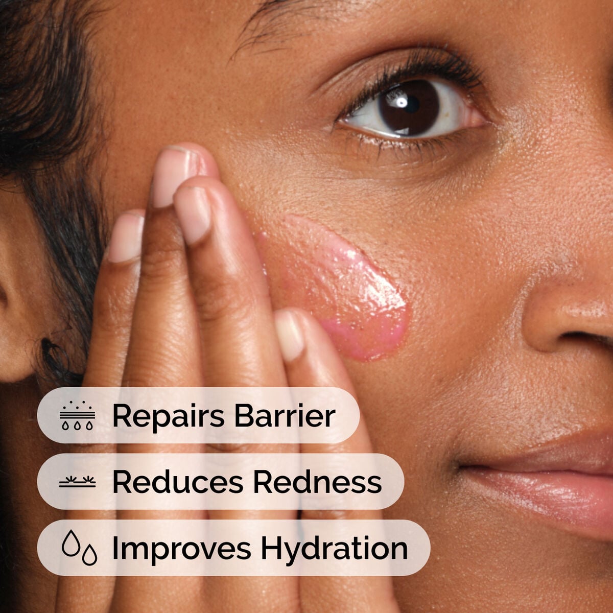 soothing-and-barrier-support-serum-set-v4 ord-soothing-barrier-support-serum-model-application-with-benefits.jpg